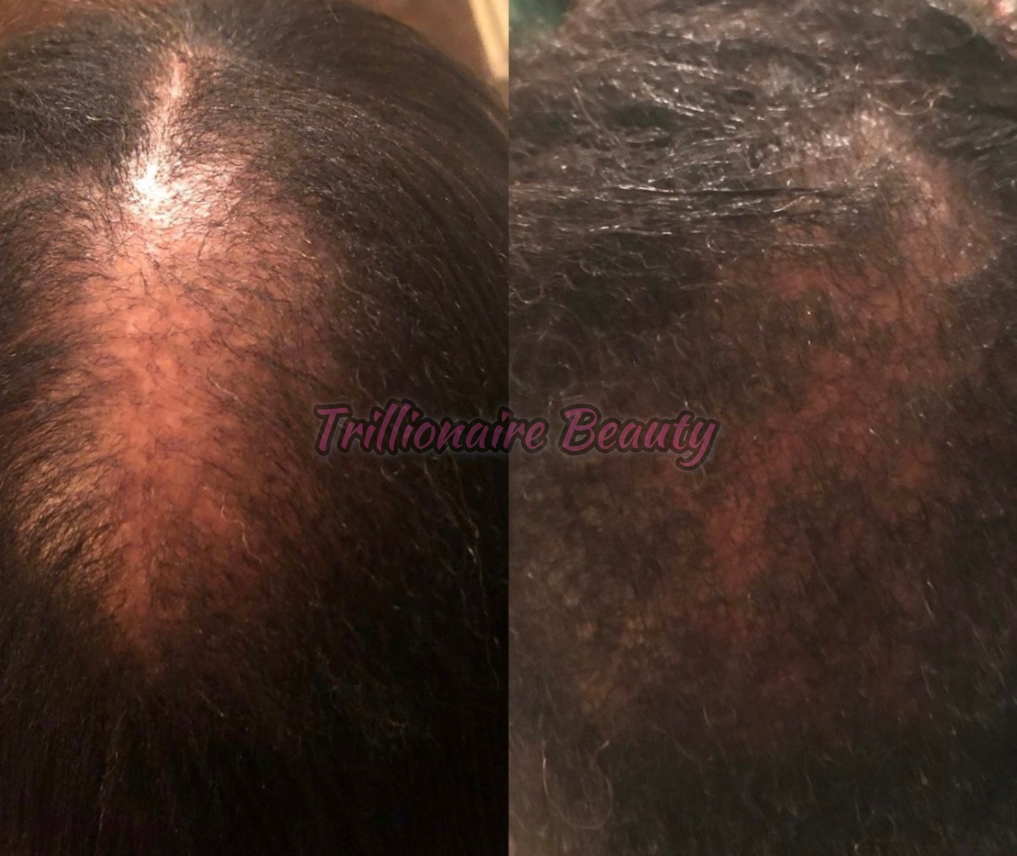“Trillionaire Goddess Follicle Awakening Elixir™”🦋