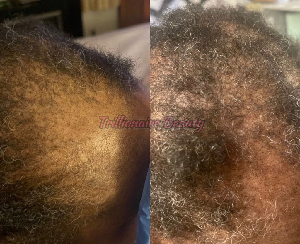 “Trillionaire Goddess Follicle Awakening Elixir™”🦋