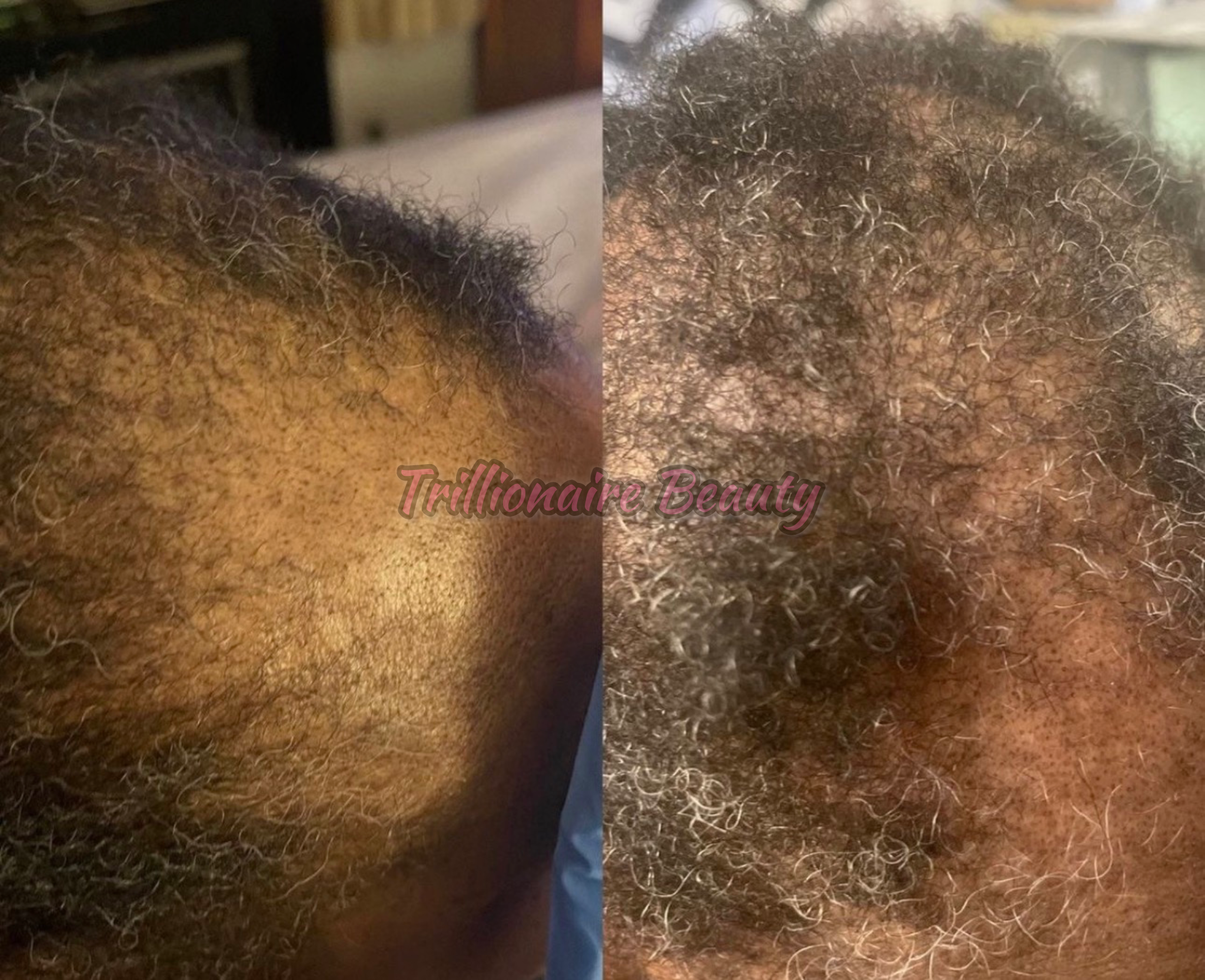 “Trillionaire Goddess Follicle Awakening Elixir™”🦋