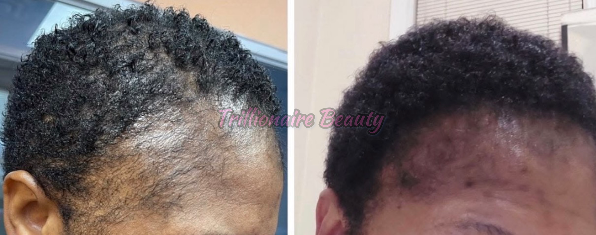 “Trillionaire Goddess Follicle Awakening Elixir™”🦋