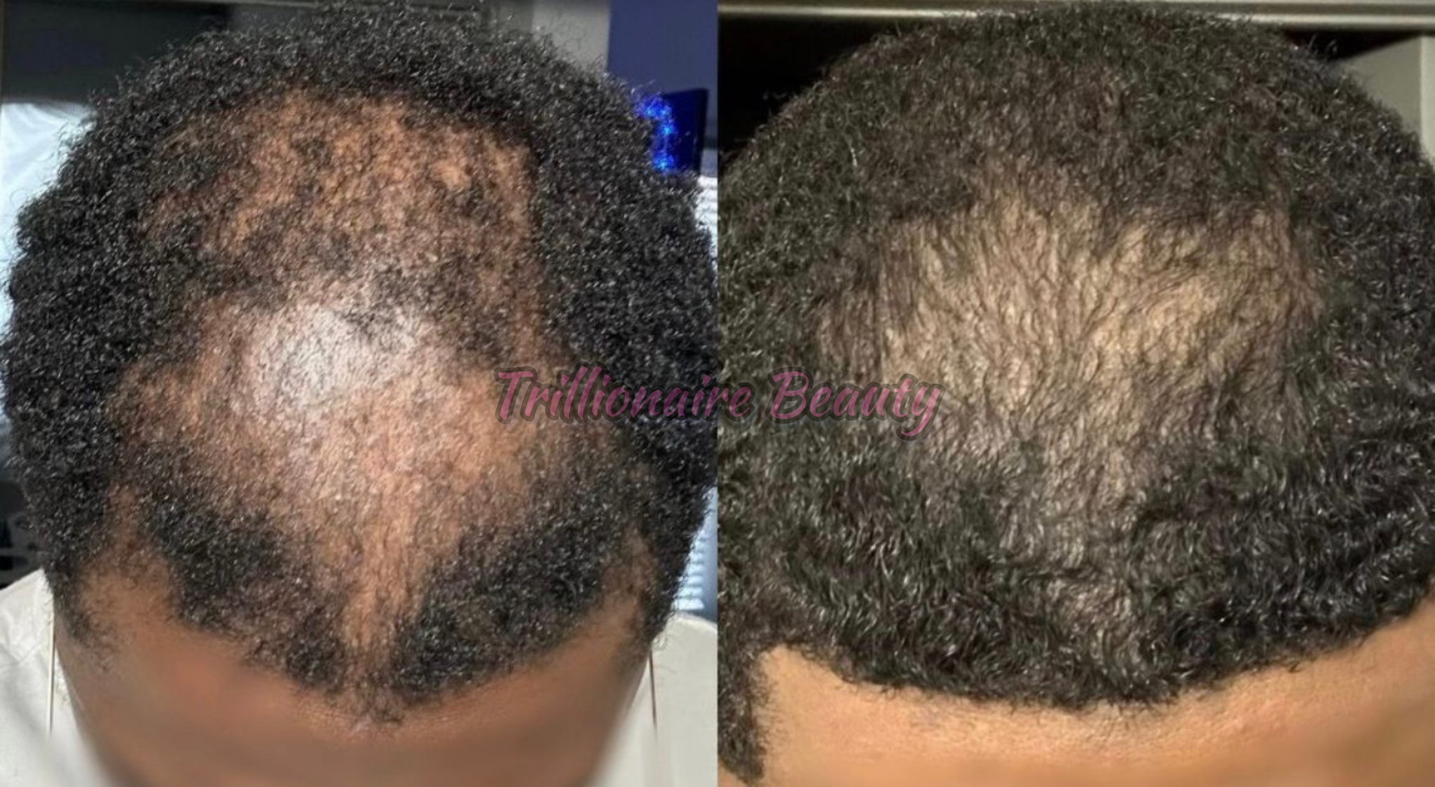 “Trillionaire Goddess Follicle Awakening Elixir™”🦋